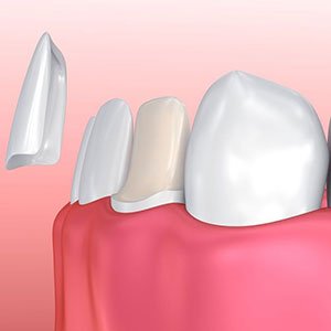 Cosmetic Dentistry
